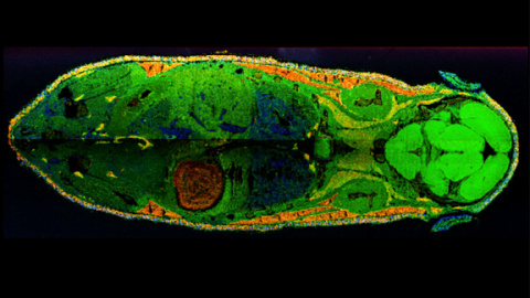 This overlay of mass spectrometry images shows the spatial distribution of three different kind of lipids across a whole mouse cross-section. Lipids act as the structural components of cell membranes and are responsible for energy storage, among other things.