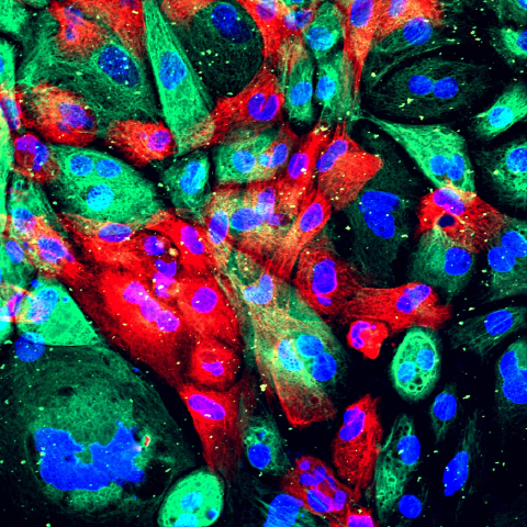 Xenograft model of prostate cancer