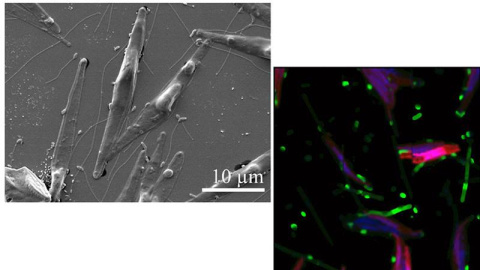 (left) The diatom Phaeodactylum tricornutum and flagellated bacteria. (right) Researchers studied P. tricornutum enriched in carbon-13 (red) derived from fixation of labeled carbon dioxide and bacterial symbionts enriched in nitrogen-15 (green).