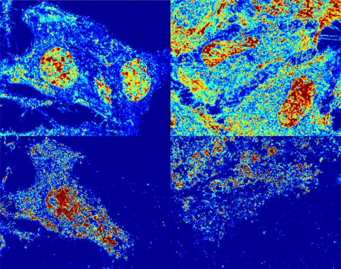 Representative mass maps are shown both before (top) and after (bottom) cellular paroxysm for cytoskeletal (left) and membrane (right) disruption.