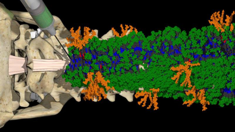 In a new injectable therapy that repairs spinal cord injuries, molecules form nanofibers that ‘dance’ around, making communication with cells to repair the injured spinal cord more likely.