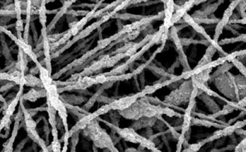 Electron microscope photo of electrospun nanofibers.