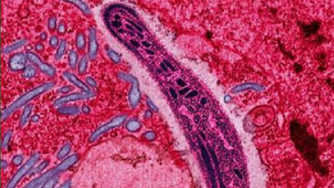 The protozoan Plasmodium falciparum gliding through a cell in the gut of a mosquito