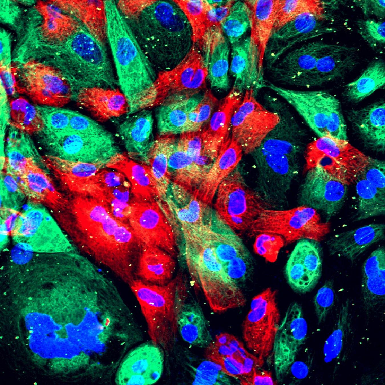 Xenograft model of prostate cancer