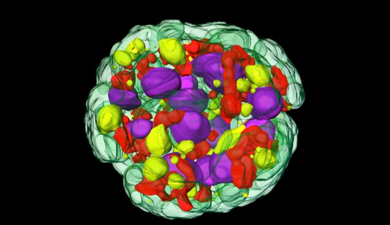 Cryo-soft X-ray tomography of an algal cell shows the large accumulation of fat (yellow). Nucleus, purple; chloroplast, green; mitochondria, red; lipid bodies, yellow.