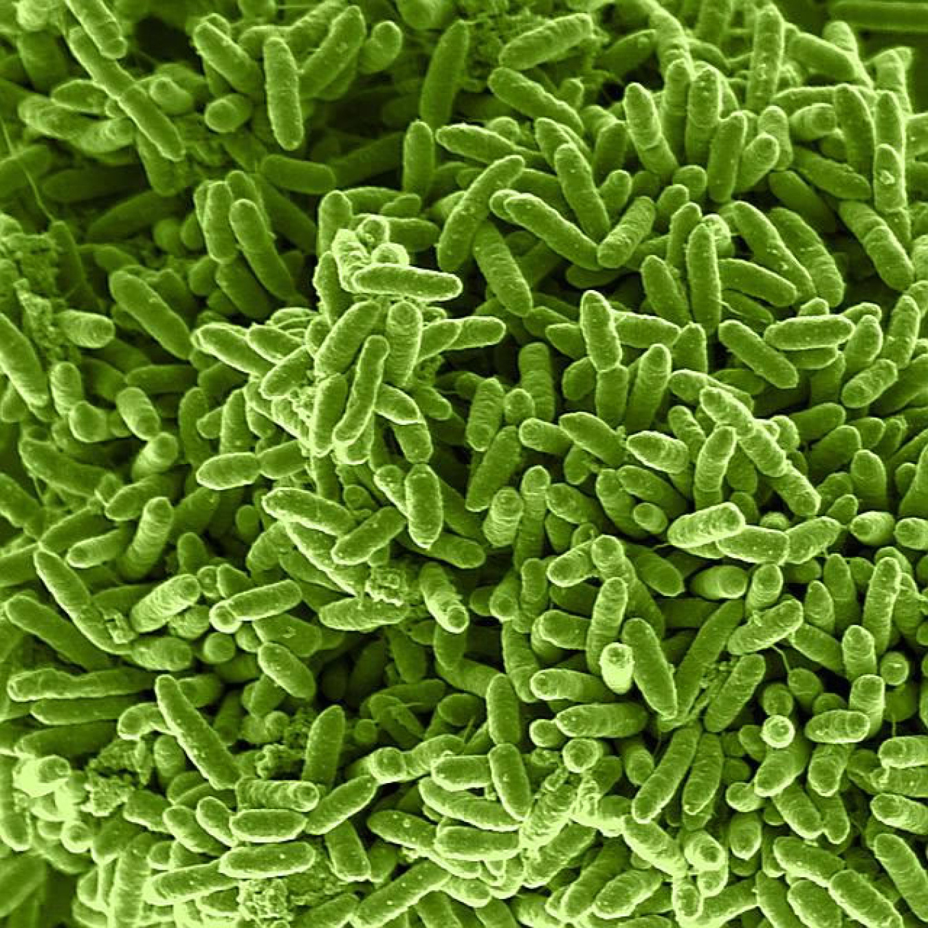 The new Serial Enrichment for Efficient Recombineering (SEER) technique allows biologists to apply recombineering-based techniques to many different species of bacteria (above, Shewanella putrefaciens bacteria).