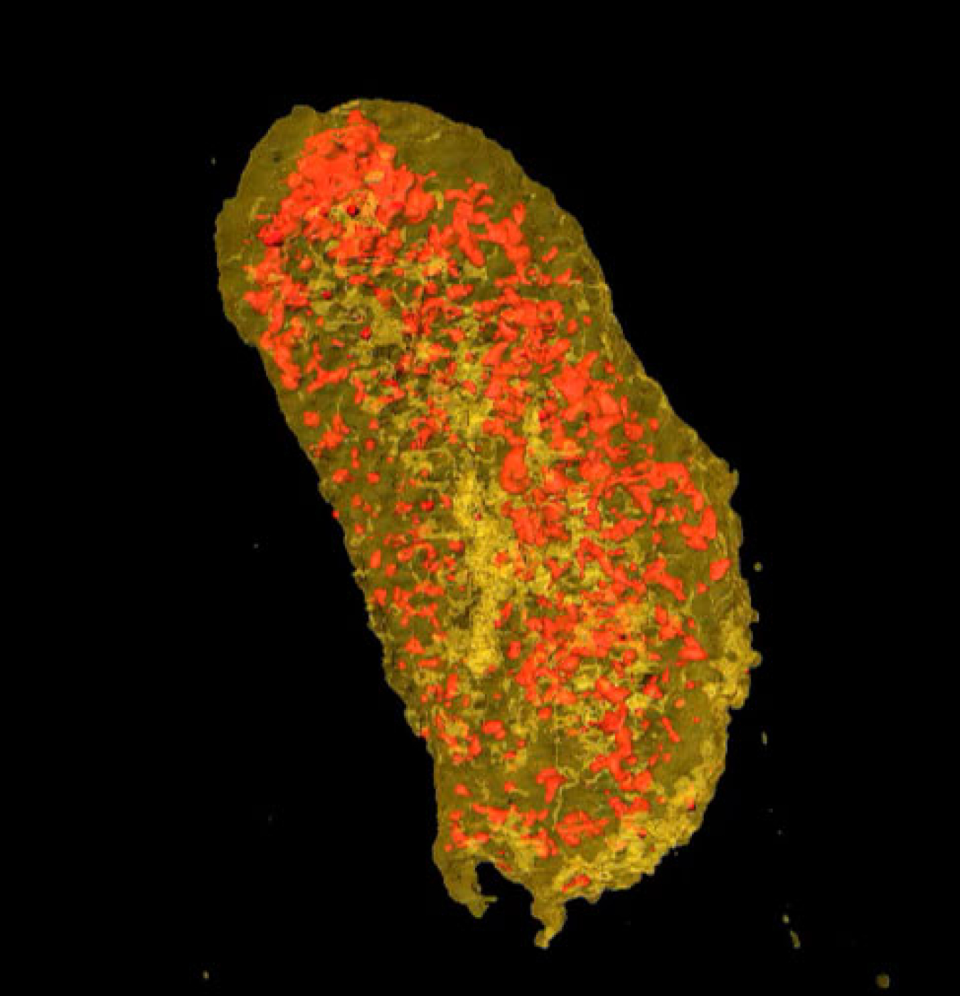 A nanoscale X-ray scan of an E.coli bacteria. Yellow represents the membrane protein, which lights up with X-rays due to a specialized tag attached to the protein. Red represents zinc, which is important for reproduction.