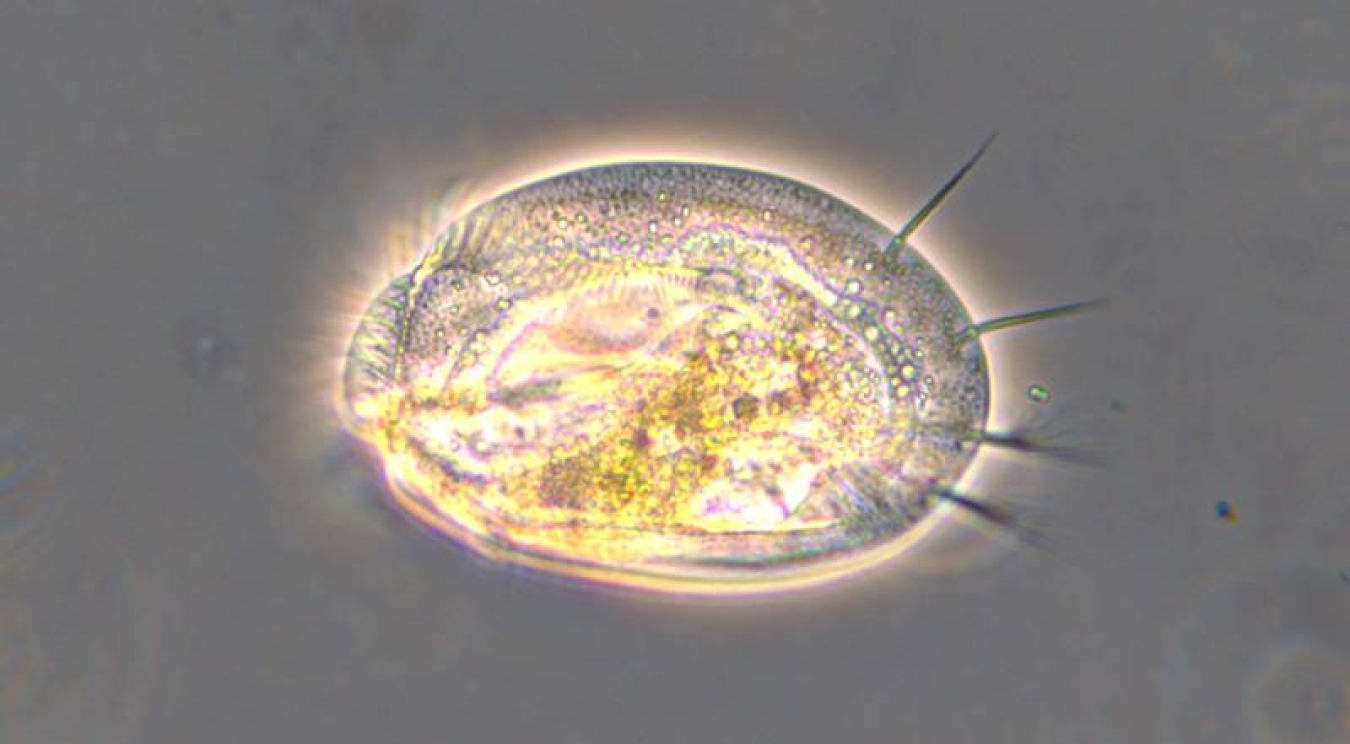 Single-celled protists like this Euplotes sp. are found in freshwater habitats worldwide and contribute to climate change by releasing carbon dioxide through respiration, a process that is changing with a warming climate.