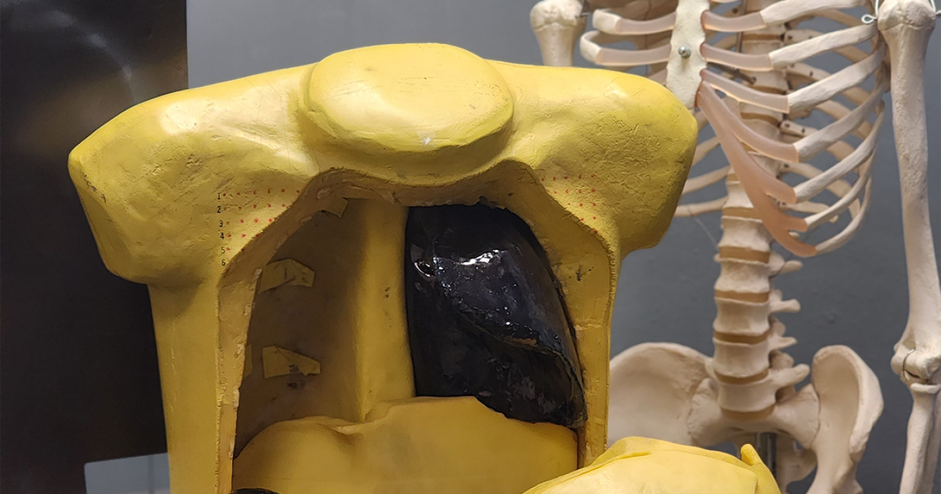 Lawrence Livermore Torso Phantom with lung and liver inserts