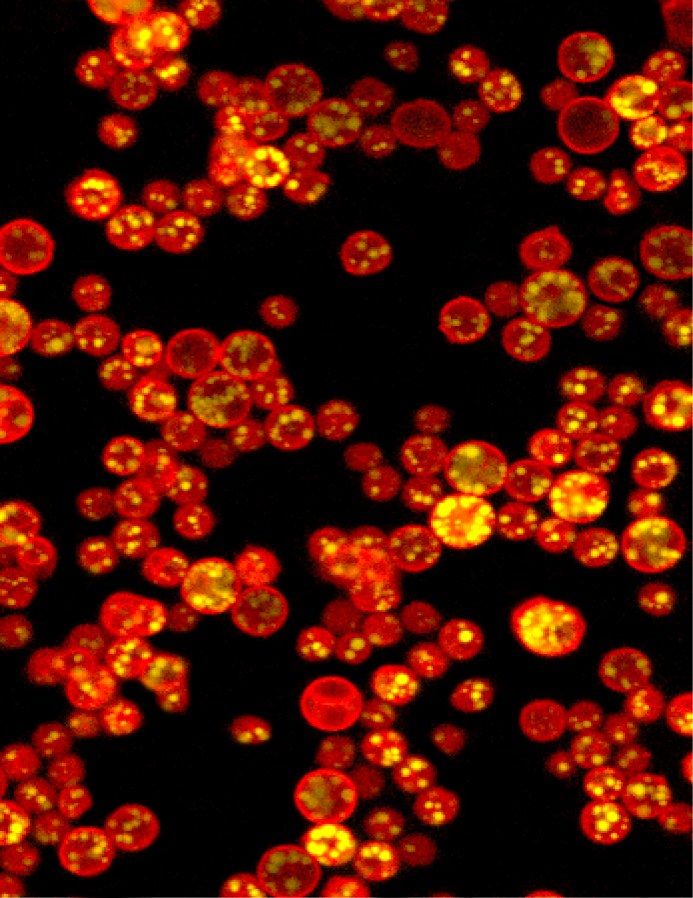 Cells of the green microalga Auxenochlorella protothecoides expressing a red fluorescent protein. These algae accumulate large quantities of oils stored in lipid droplets.