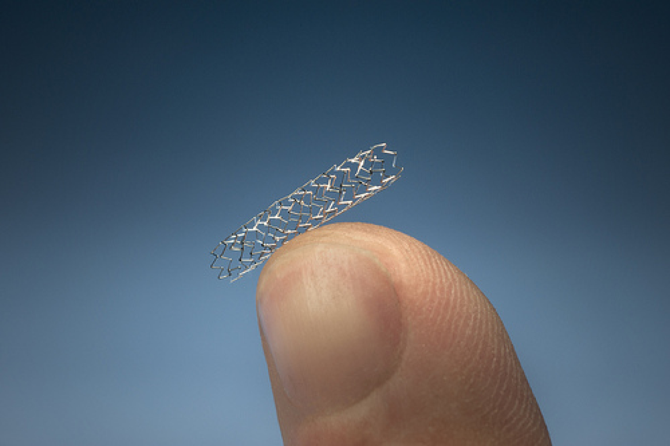stent_perspective.jpg