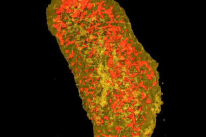 A nanoscale X-ray scan of an E.coli bacteria. Yellow represents the membrane protein, which lights up with X-rays due to a specialized tag attached to the protein. Red represents zinc, which is important for reproduction. 