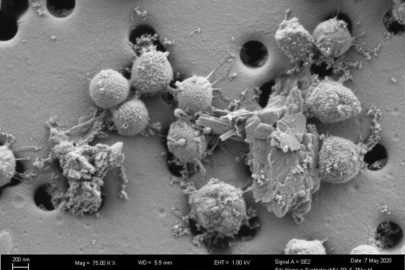 Electron micrograph of the microorganism Methanococcus voltae grown with pyrite. The pyrite grains are attached to coccoid cells that have extracellular appendages that connect the cells to each other. Scale bar is 200 nanometers.