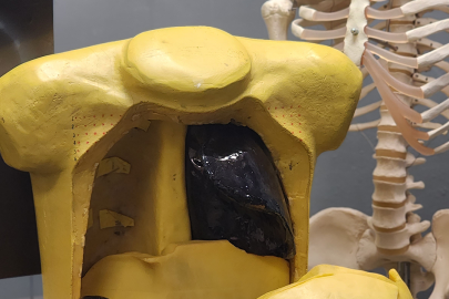 Department of Energy Lab Produces World’s First-of-a-Kind Lung Phantom