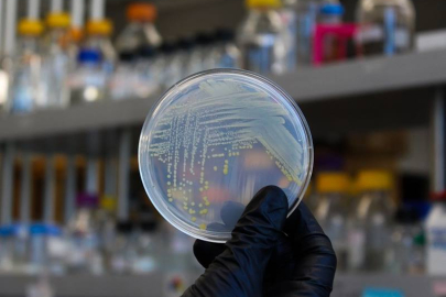 A petri plate with bacterial colonies.