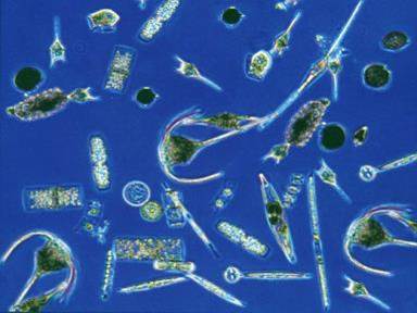 A microscope image of a mircroalgae culture sample Credit: CAB-Comm Culture sample