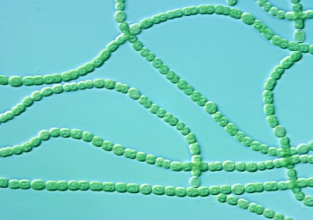 Chains of cyanobacteria, also known as blue-green algae | Photo Courtesy of Argonne National Laboratory Chains of cyanobacteria, also known as blue-green algae | Photo Courtesy of Argonne National Laboratory