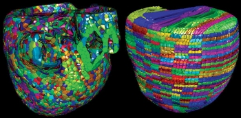 The Cardioid code developed by a team of Livermore and IBM scientists divides the heart into a large number of manageable pieces, or subdomains. The development team used two approaches, called Voronoi (left) and grid (right), to break the enormous computing challenge into much smaller individual tasks. | Photo from the Lawrence Livermore National Laboratory The Cardioid code developed by a team of Livermore and IBM scientists divides the heart into a large number of manageable pieces, or subdomains. The development team used two approaches, called Voronoi (left) and grid (right), to break the enormous computing challenge into much smaller individual tasks. | Photo from the Lawrence Livermore National Laboratory