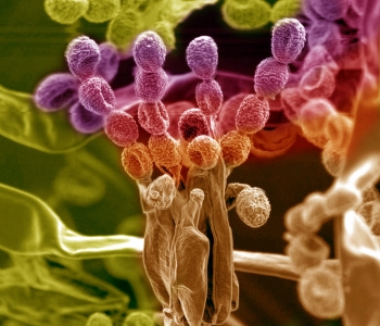 Studying the Rhizosphere