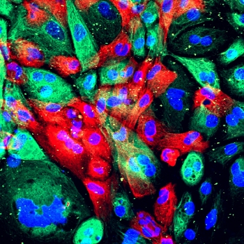 Xenograft model of prostate cancer