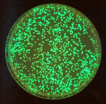 Smart microbial cell colonies "light up" when enzyme activity is high. Photo: Los Alamos National Laboratory