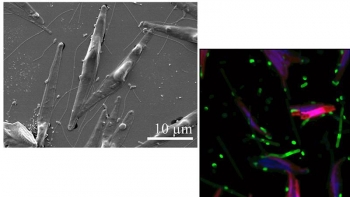 (left) The diatom Phaeodactylum tricornutum and flagellated bacteria. (right) Researchers studied P. tricornutum enriched in carbon-13 (red) derived from fixation of labeled carbon dioxide and bacterial symbionts enriched in nitrogen-15 (green). (left) The diatom Phaeodactylum tricornutum and flagellated bacteria. (right) Researchers studied P. tricornutum enriched in carbon-13 (red) derived from fixation of labeled carbon dioxide and bacterial symbionts enriched in nitrogen-15 (green).
