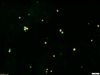 Microcospy images of P. soloecismus