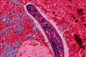 The protozoan Plasmodium falciparum gliding through a cell in the gut of a mosquito, its primary host. Although five different species of Plasmodium can cause malaria, Plasmodium falciparum causes the most severe disease. | Photo courtesy of Wikipedia Commons. <a href="http://energy.gov/articles/malaria-researchers-find-weakness-global-killer">Read more</a> The protozoan Plasmodium falciparum gliding through a cell in the gut of a mosquito, its primary host. Although five different species of Plasmodium can cause malaria, Plasmodium falciparum causes the most severe disease. | Photo courtesy of Wikipedia Commons. <a href="http://energy.gov/articles/malaria-researchers-find-weakness-global-killer">Read more</a>